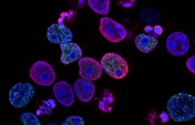 Le modèle PRISM2 utilise le dialogue clinique pour interpréter les diapositives de pathologie